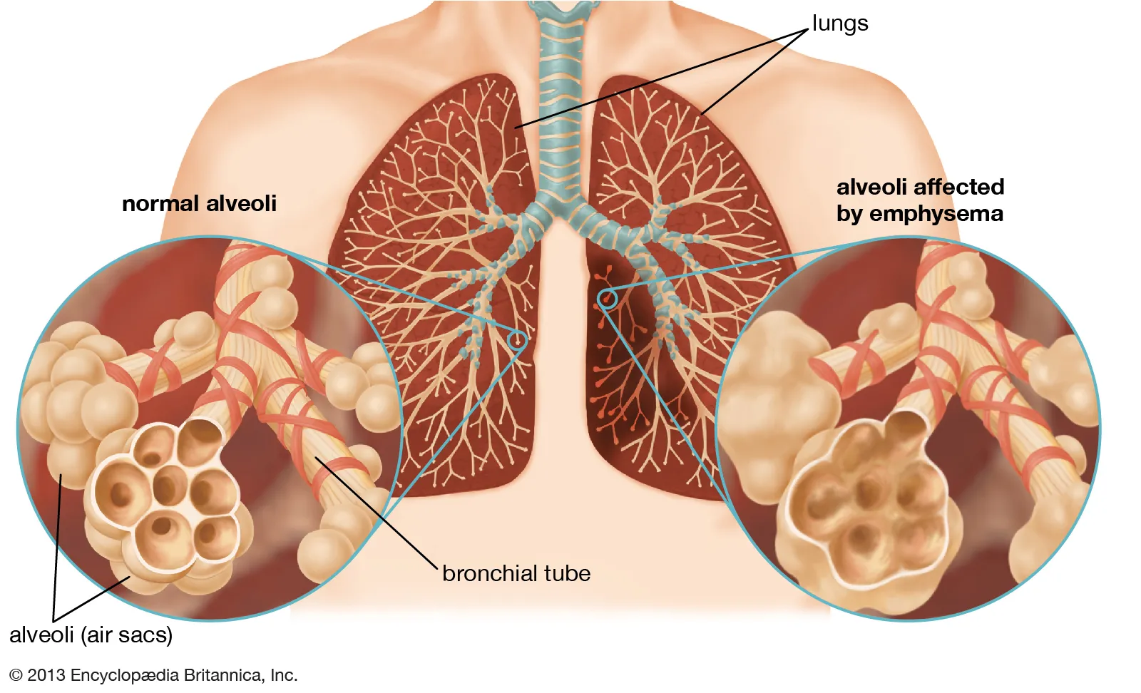 Respiratory Problems